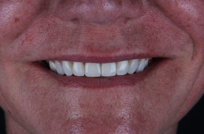 After - Cheadle Hulme Dental