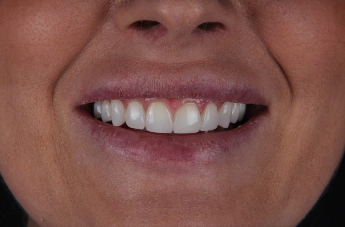 After - Cheadle Hulme Dental