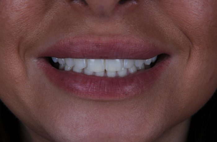 Before - Cheadle Hulme Dental