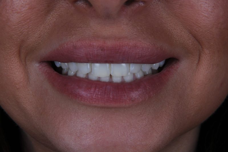 Before - Cheadle Hulme Dental