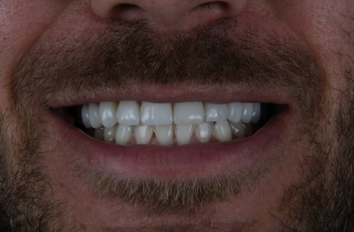 After - Cheadle Hulme Dental