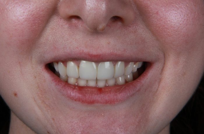 After - Cheadle Hulme Dental