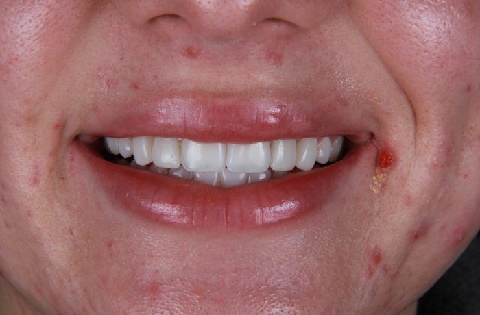 After - Cheadle Hulme Dental
