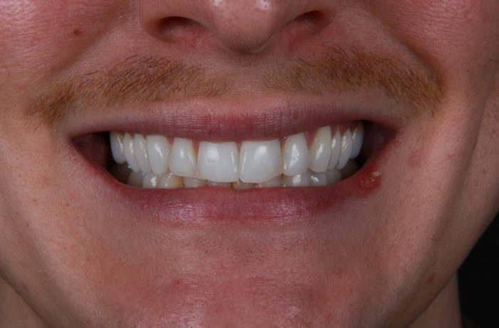 Before - Cheadle Hulme Dental