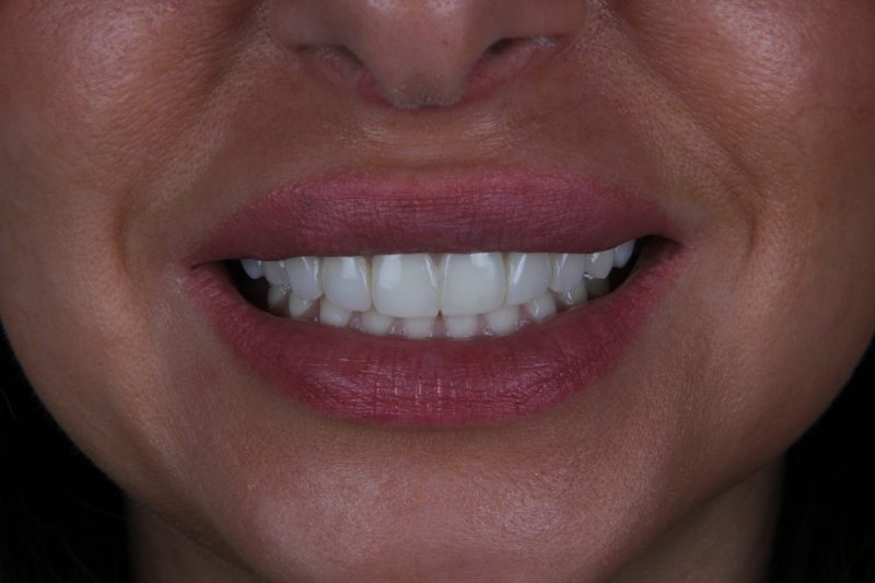 After - Cheadle Hulme Dental