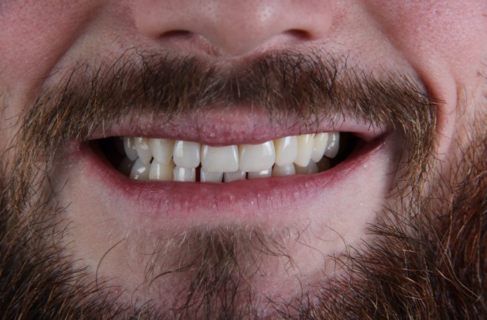 After - Cheadle Hulme Dental
