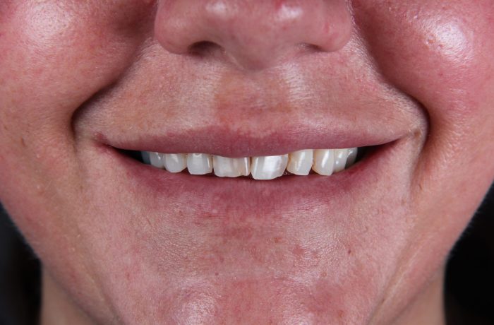Before - Cheadle Hulme Dental