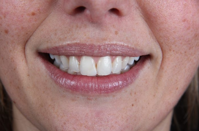 Before - Cheadle Hulme Dental
