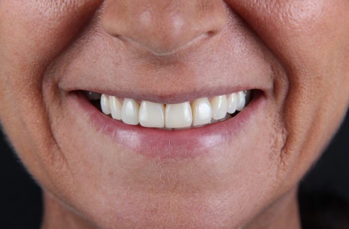 After - Cheadle Hulme Dental