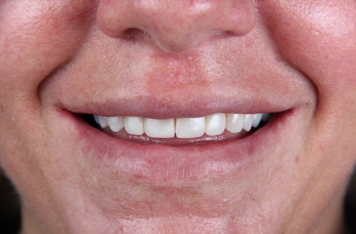 After - Cheadle Hulme Dental
